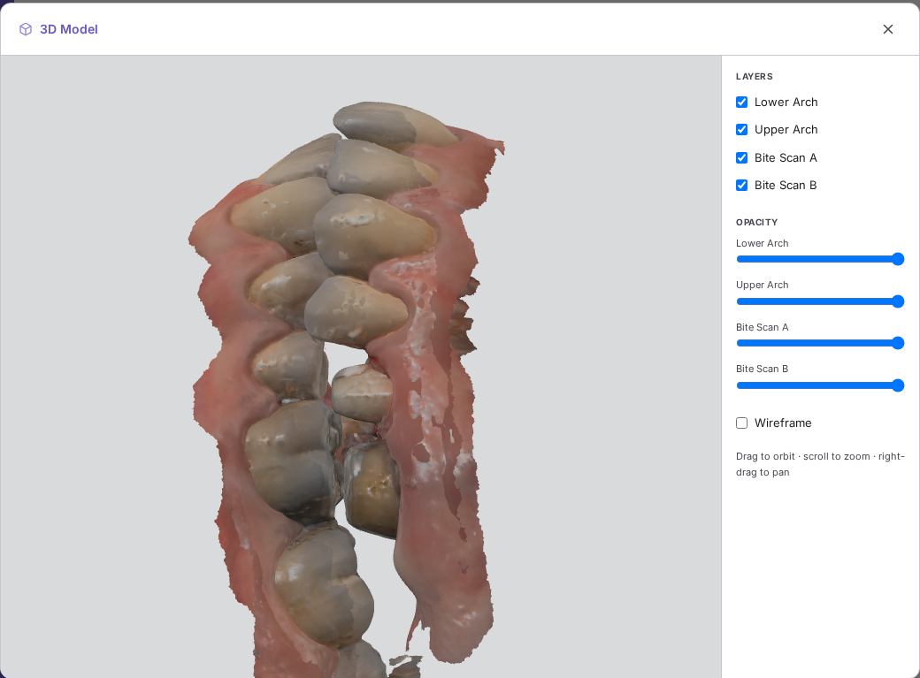 The Vertex portal's 3D scan viewer, showing an upper and lower jaw scan in true color